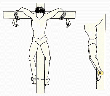 Nails through ankle bones